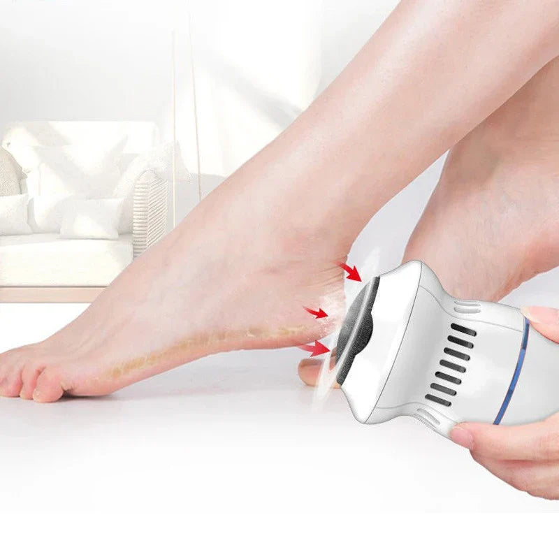 Powerful Electric Callus Remover | Ergonomic & Rechargeable Dead Skin Foot Remover 0